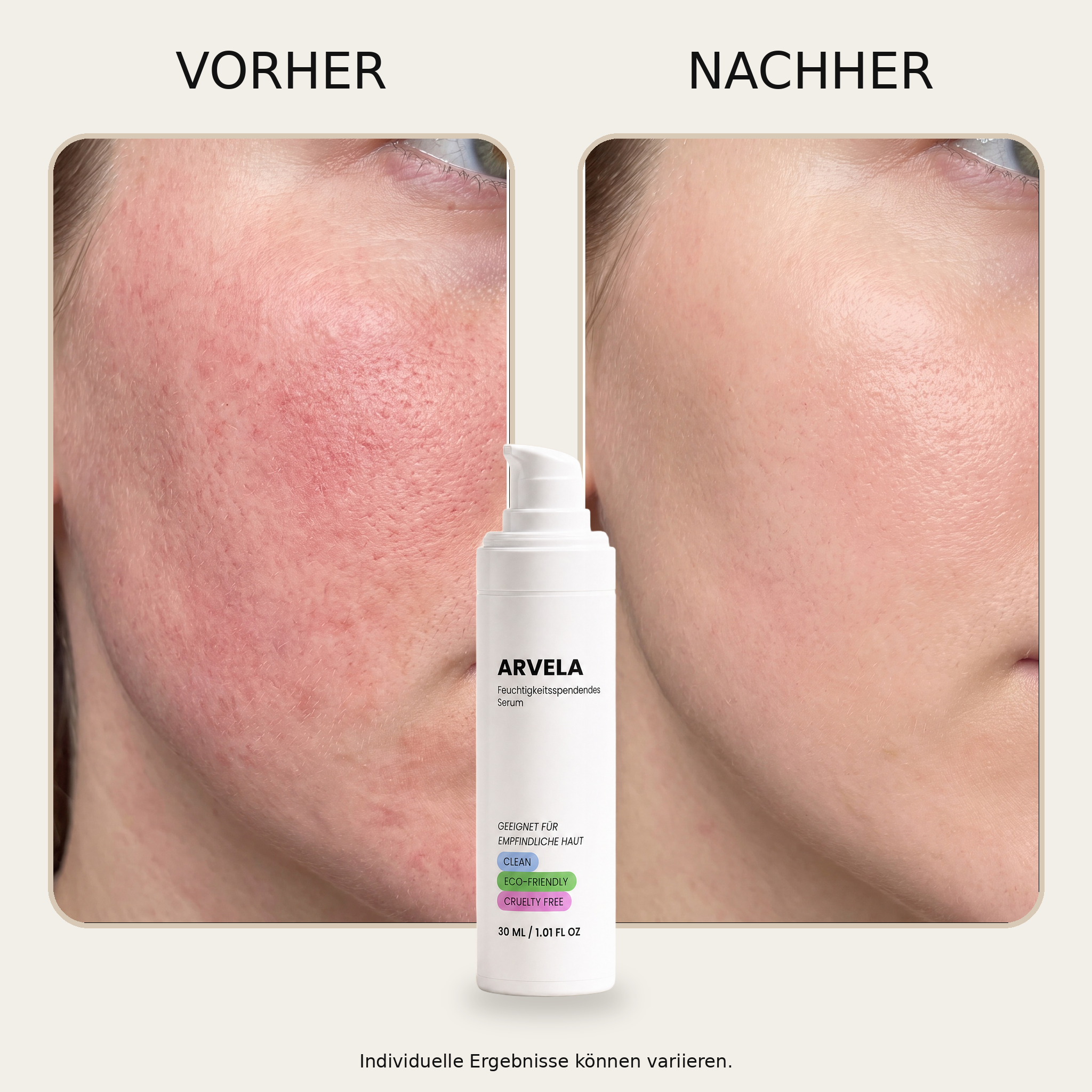 ARVELA Hyaluron-Serum